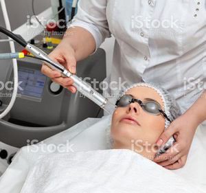 Microdermabrasion